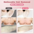 YOOVEE Laser Hair Removal Device IPL Hair Removal Permanent for Women Men at-Home, Painless Laser Hair Removal Whole Body Armpits Back Legs Arms Face Bikini Line
